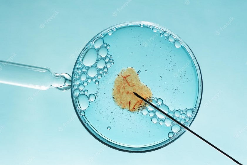 The Role of Myo-Inositol in Fertility Treatments