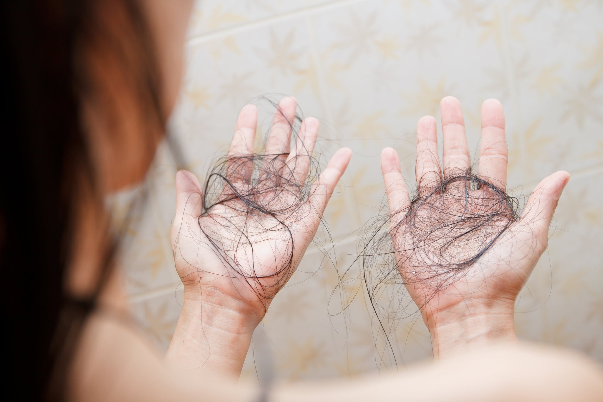 Hair Thinning
